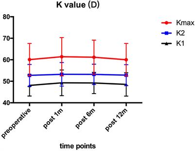 One-Year Follow-Up of Corneal Biomechanical Changes After Accelerated Transepithelial Corneal Cross-Linking in Pediatric Patients With Progressive Keratoconus